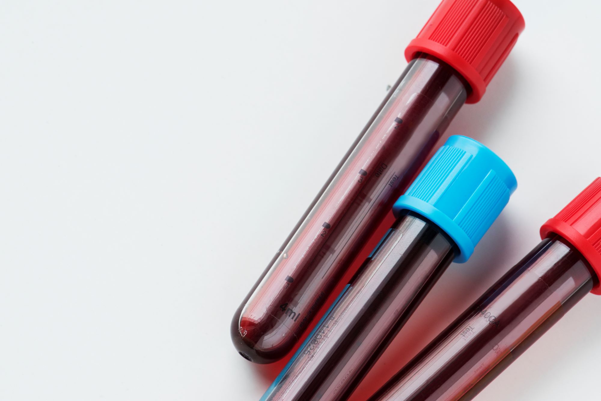 travel health private blood test centrifuge services