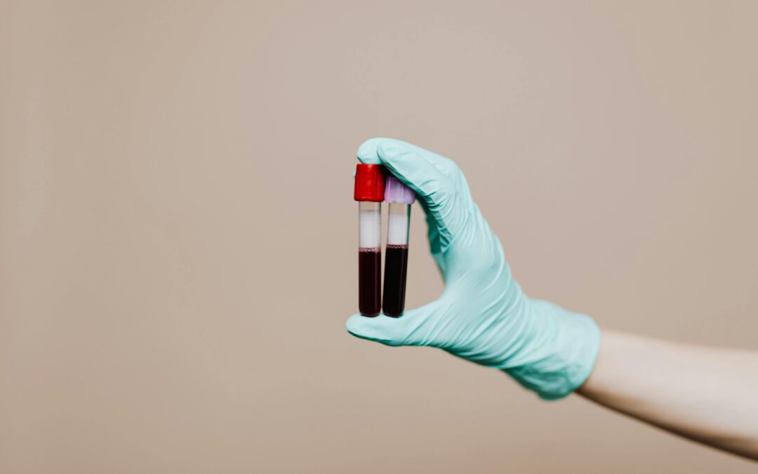 Blood Testing in Hampshire: Private Blood Tests with Same Day Appointments